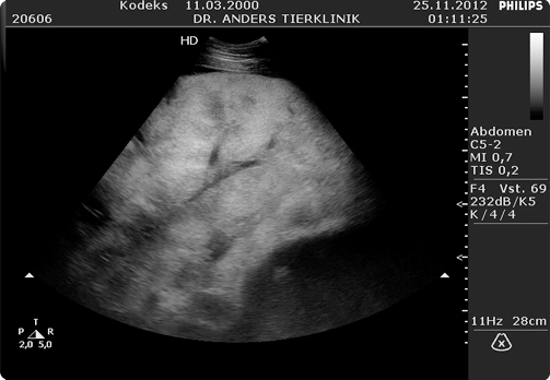 Ultraschall Lebertumor